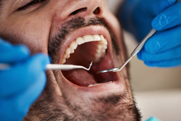 Dental Bonding in Ten Mile Creek, MD